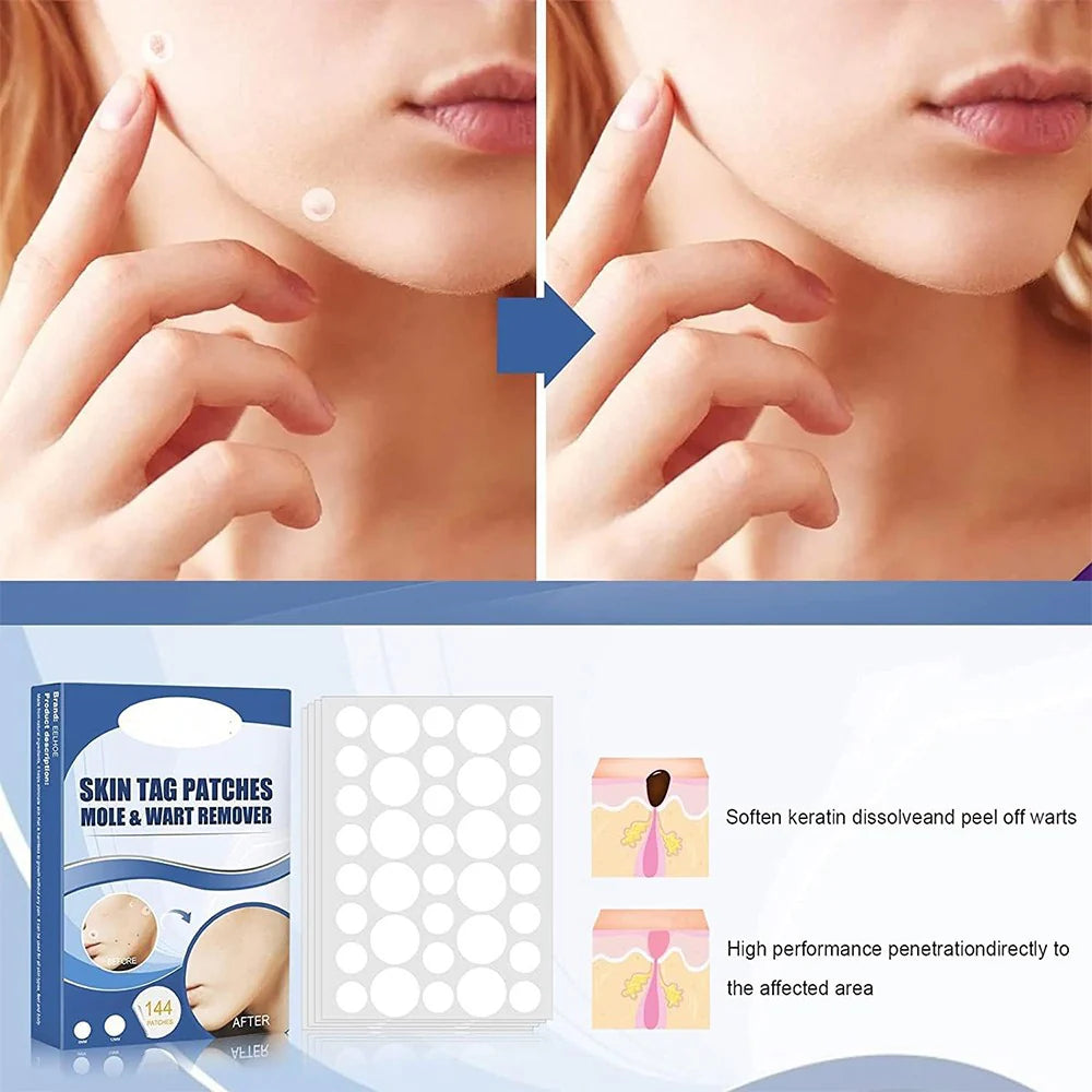 PatchAway™ – Hautlappen schmerzfrei, sicher & mühelos entfernen & pflegen [1 + 1 Gratis]