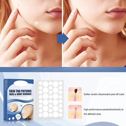 PatchAway™ – Hautlappen schmerzfrei, sicher & mühelos entfernen & pflegen [1 + 1 Gratis]
