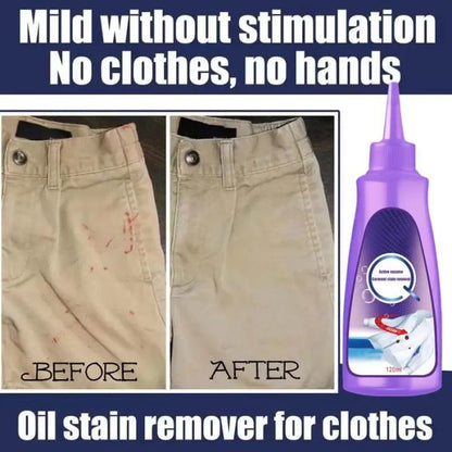 Laundry Stain Remover™ (70% OFF)