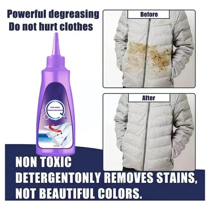 Laundry Stain Remover™ (70% OFF)