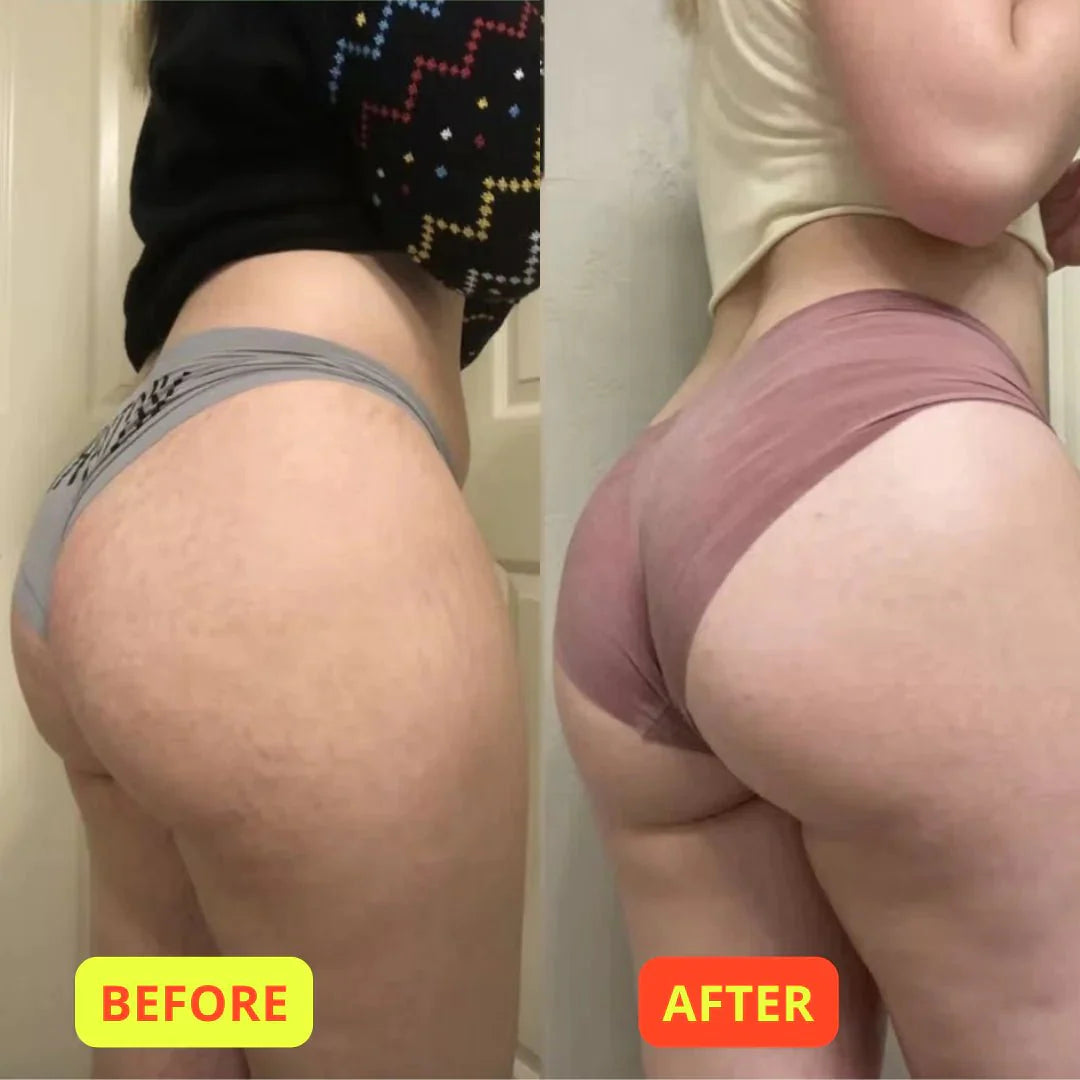 Gymology Glute Trainer Non VIP Offer